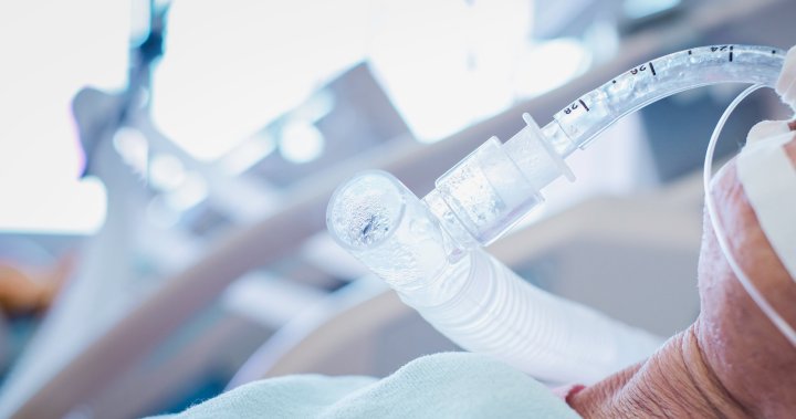 Un anciano de EE. UU. Se despierta del coma COVID-19 el día que debe ser retirado del sistema de reanimación – National