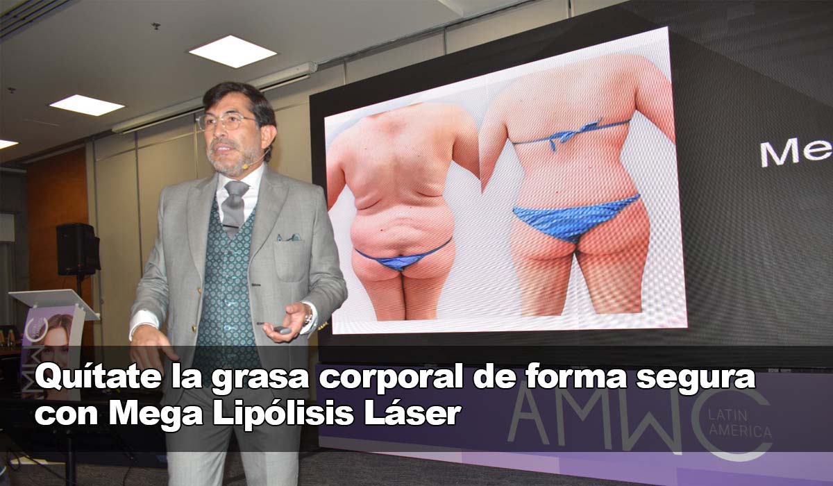 Eliminación de grasa corporal segura con Mega Lipólisis Láser